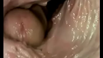 Camera inside vagina